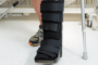 Ankle Fractures and Physical Therapy: A Comprehensive Guide